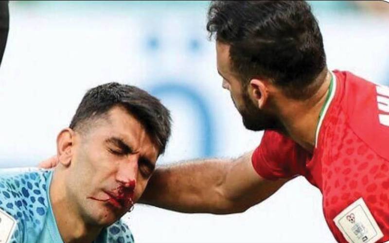 خطری که از بیخ گوش بیرانوند گذشت